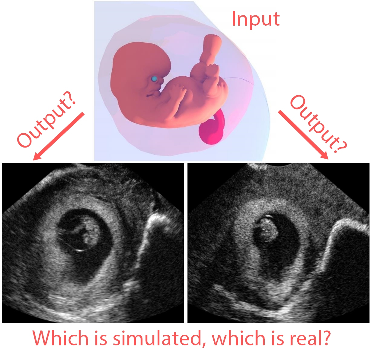 Fetus Simulation
